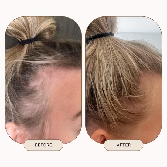 All Natural Organic Repairing Growth Scalp Care Rosemary Oil for Hair Growth